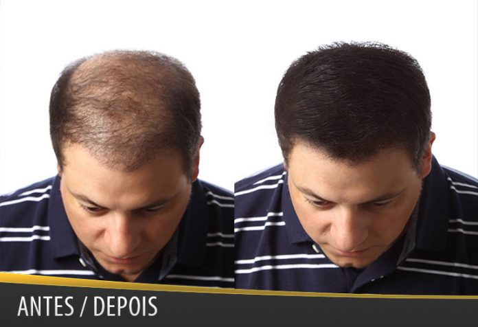 antes_depois